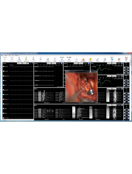 Sistema de Monitorizaci&oacute;n Intraoperatoria de 32 Canales + TMS Neuro-IOM-32/B